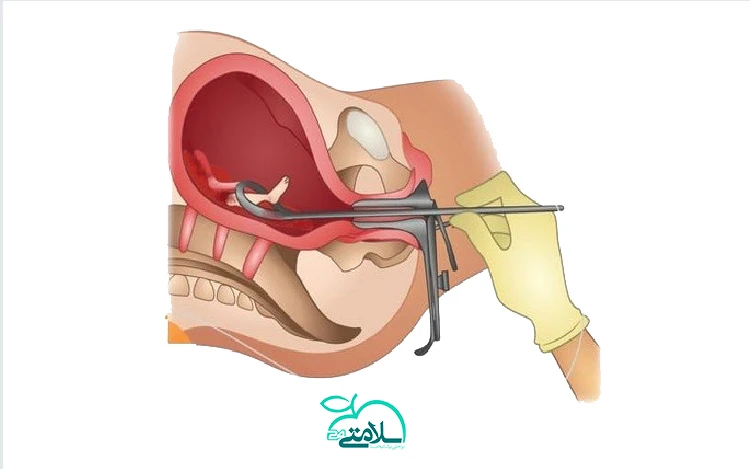 تمام آنچه که باید درباره کورتاژ بدانید